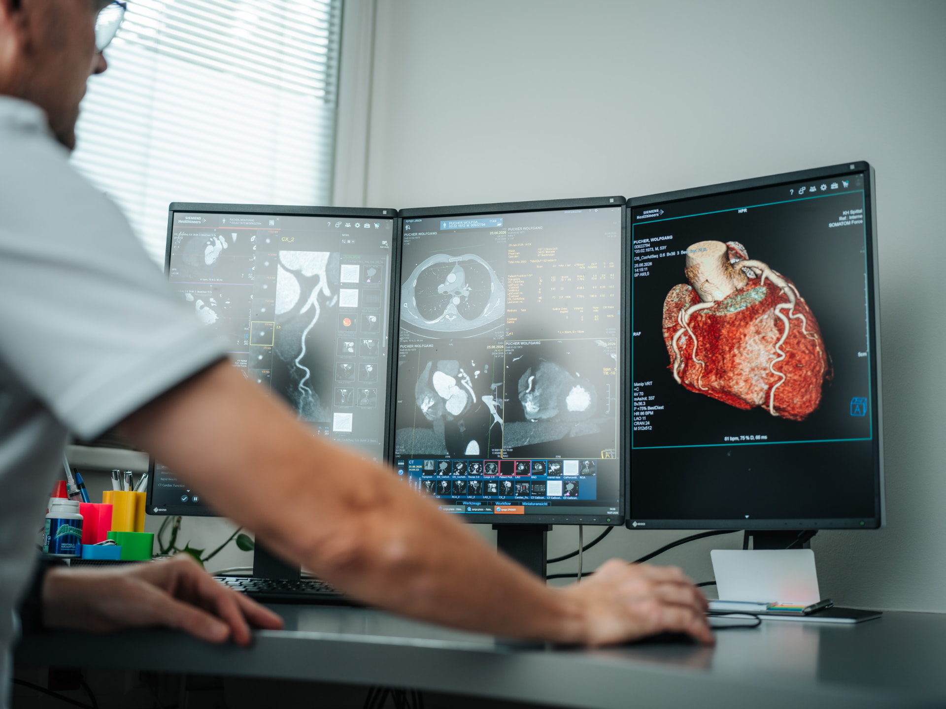 Befundung eines Herz-CT mit 3D-Rekonstruktion der Herzkranzgefäße am Siemens SOMATOM Force